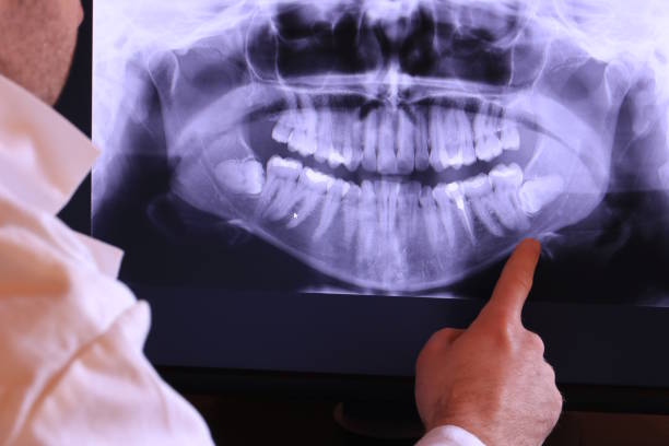 Trusted WV Emergency Dental Service Experts